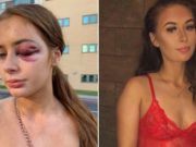 Golpeó a una mujer y la dejó inconsciente porque lo rechazó en un boliche